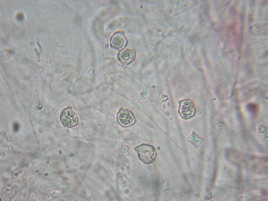 Sotto alberi fruttiferi ....